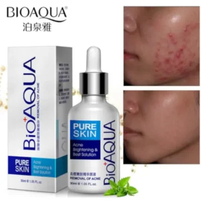 serum-anti-acne-BIOAQUA-min Serum Anti Acne BIOAQUA